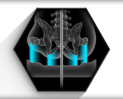 Anthropometrics Axiom AS - ASP Ki Mobility Cushion